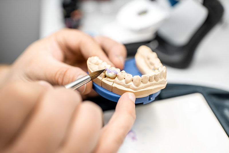 close up of tooth model being molded for patient