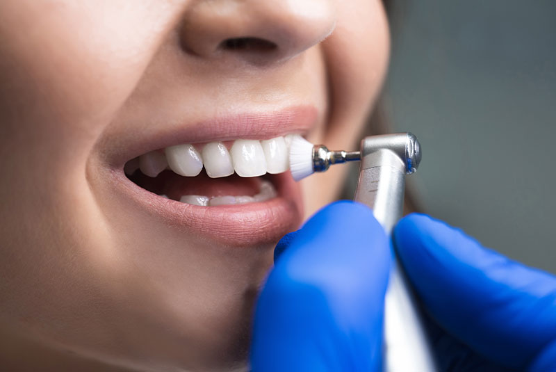Dental Cleanings Naples FL