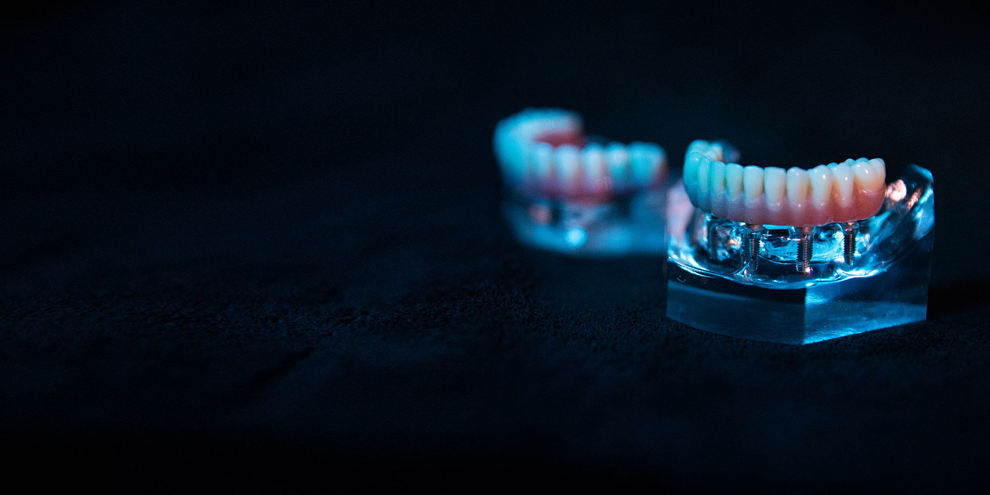 close up of multiple dental implant models