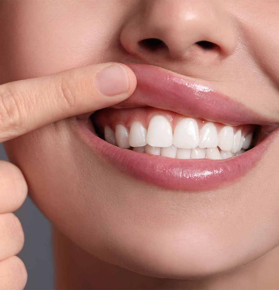 close up of patient showing off their gums