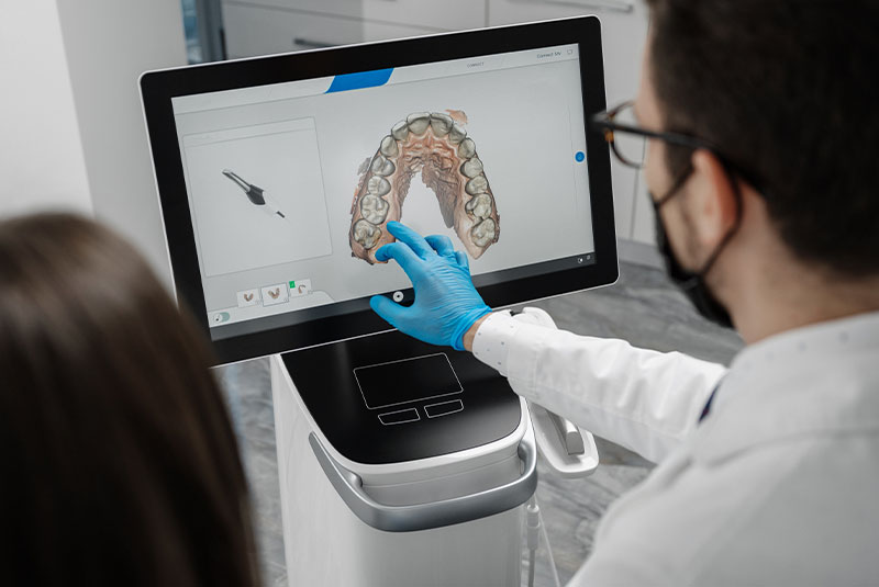 Custom smile design