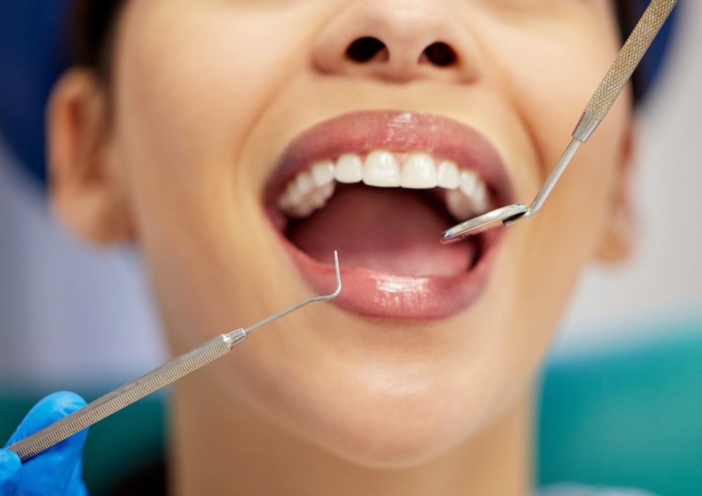 A person with their mouth open at a dental exam; a gloved hand holds dental instruments near their clean teeth. The focus is on the mouth, showing healthy gums and teeth.