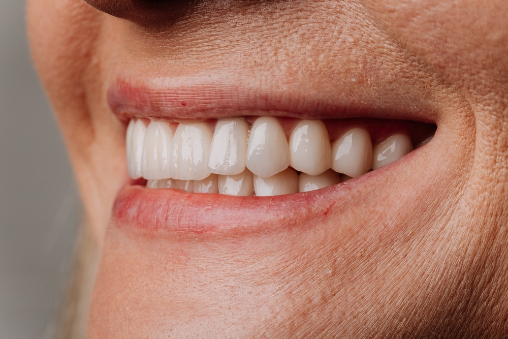 Close-up of a smiling person’s mouth showing clean, straight, white teeth and healthy pink lips. The skin around the mouth is lightly textured and the overall appearance suggests good dental health.